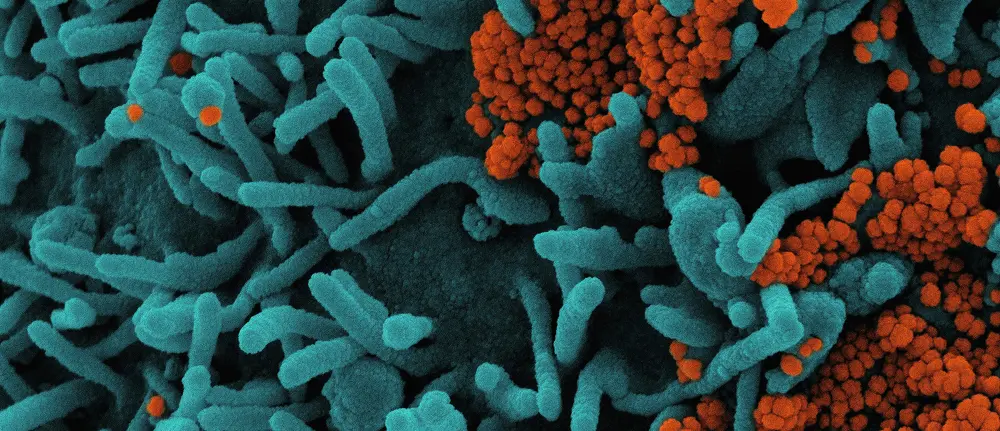 Close-up view of Legionella bacteria under a microscope